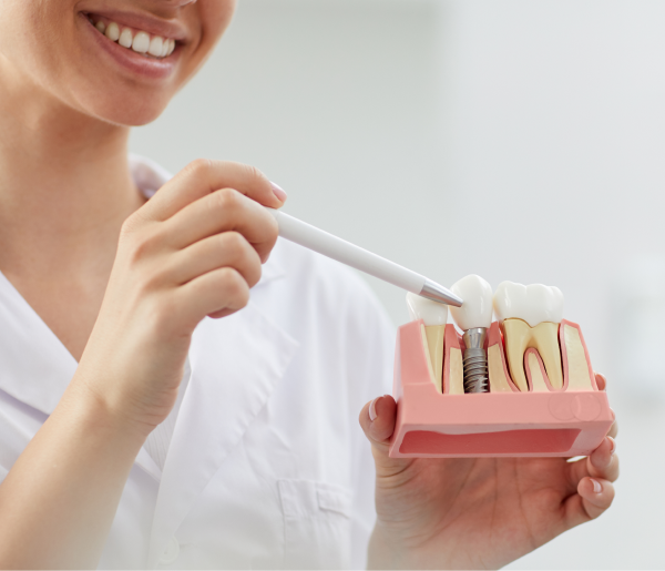 Дентальная имплантация